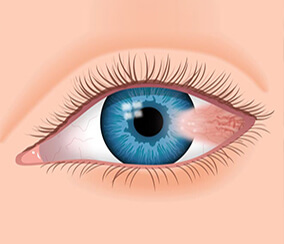 Top and Best Eye Hospitals in Hyderabad