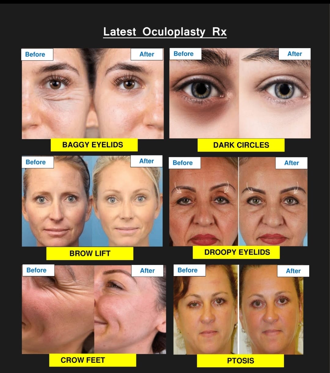 oculoplasty-services